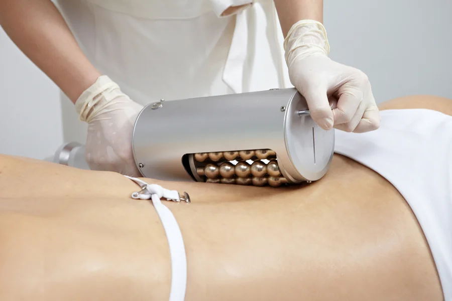 Tratamiento de estética corporal en Montevideo – Bioestimulación